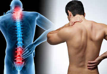 backache - Dr. Khushbu Goel backache